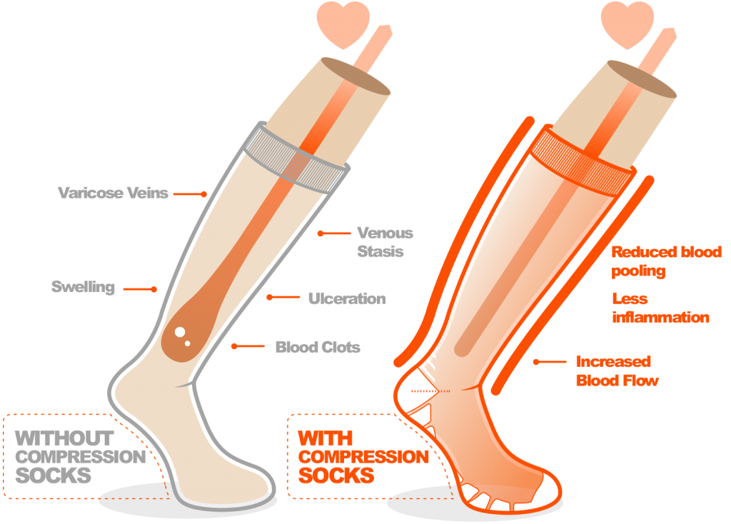 How Long Should You Wear Compression Socks For Better Blood